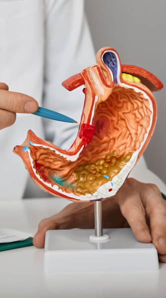 Gastro em Belo Horizonte | Gastroenterologista em Belo Horizonte | Dr. Tomás Dornelas